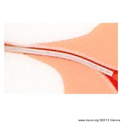 Ovabloc